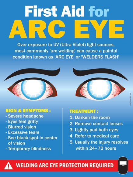 How Do You Know If You Have Arc Eye?